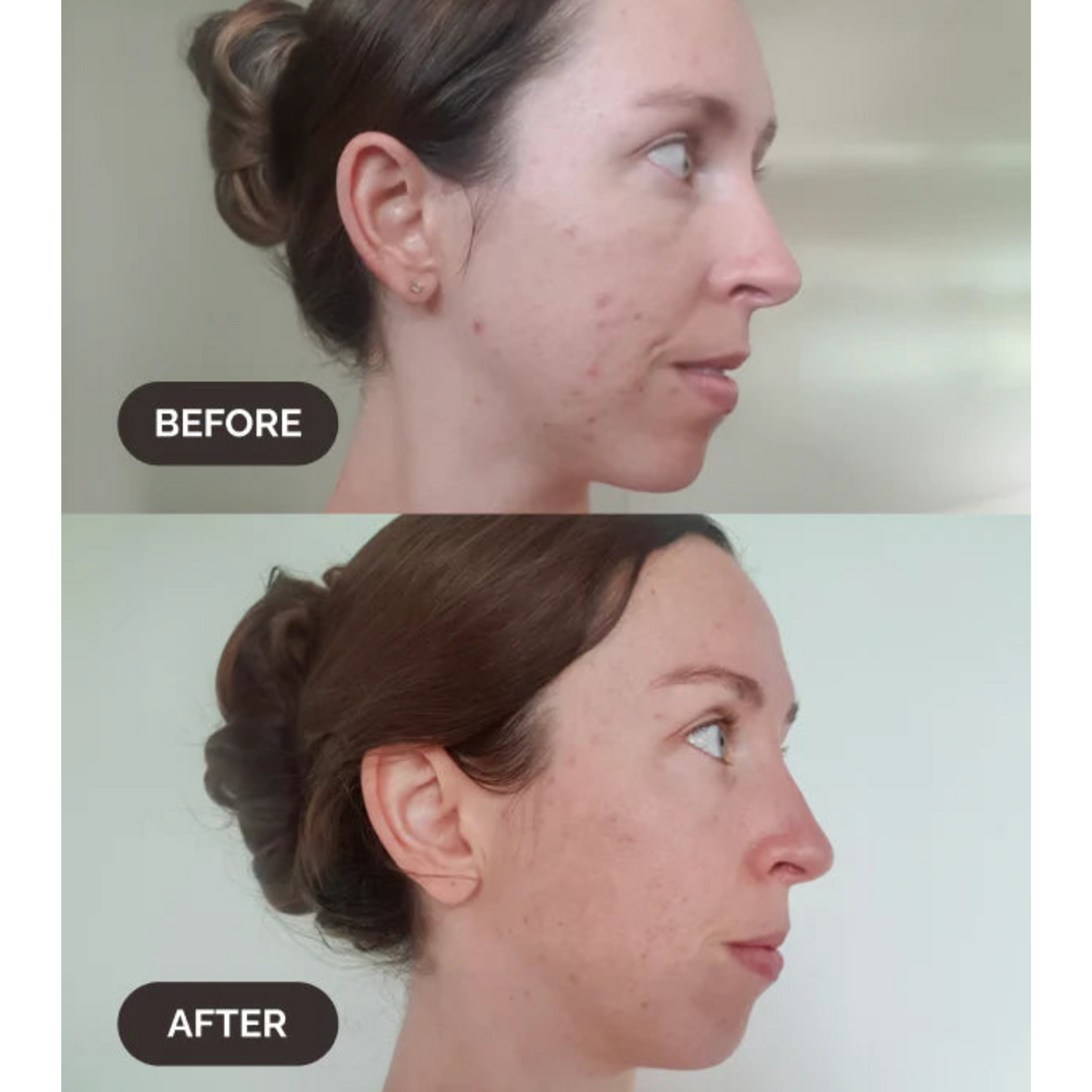 LAMAV BAKUCHIOL 4% Natural Retinol Alternative Booster | 30ml